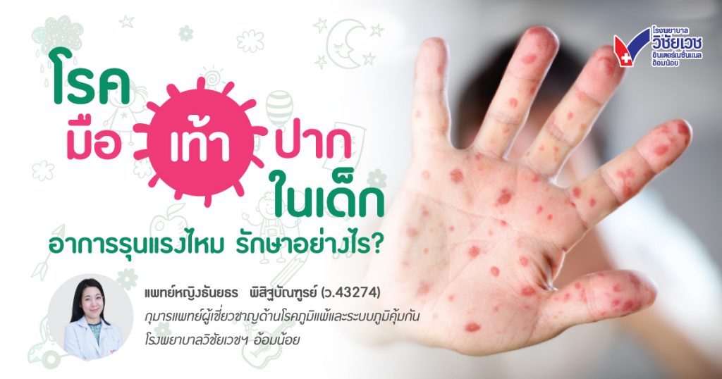 โรคมือเท้าปากในเด็ก อันตรายไหม? รู้ทันอาการ วิธีรักษา และป้องกัน