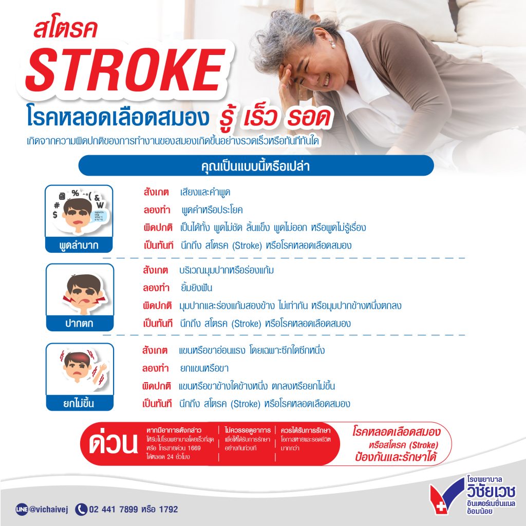 สโตรค STROKE โรคหลอดเลือดสมอง รู้ เร็ว รอด