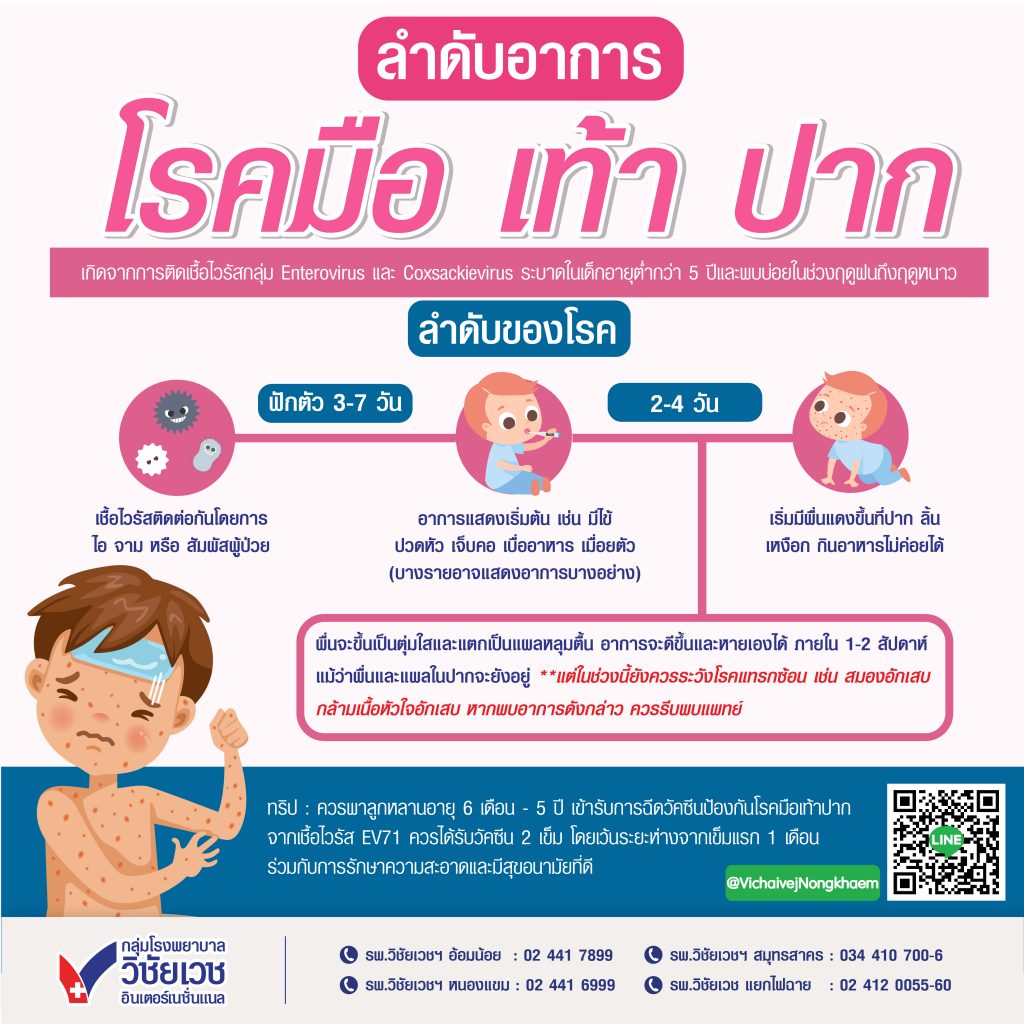 ลำดับอาการโรคมือเท้าปาก