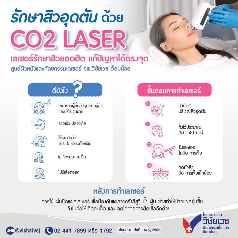 รักษาสิวอุดตัน CO2 LASER