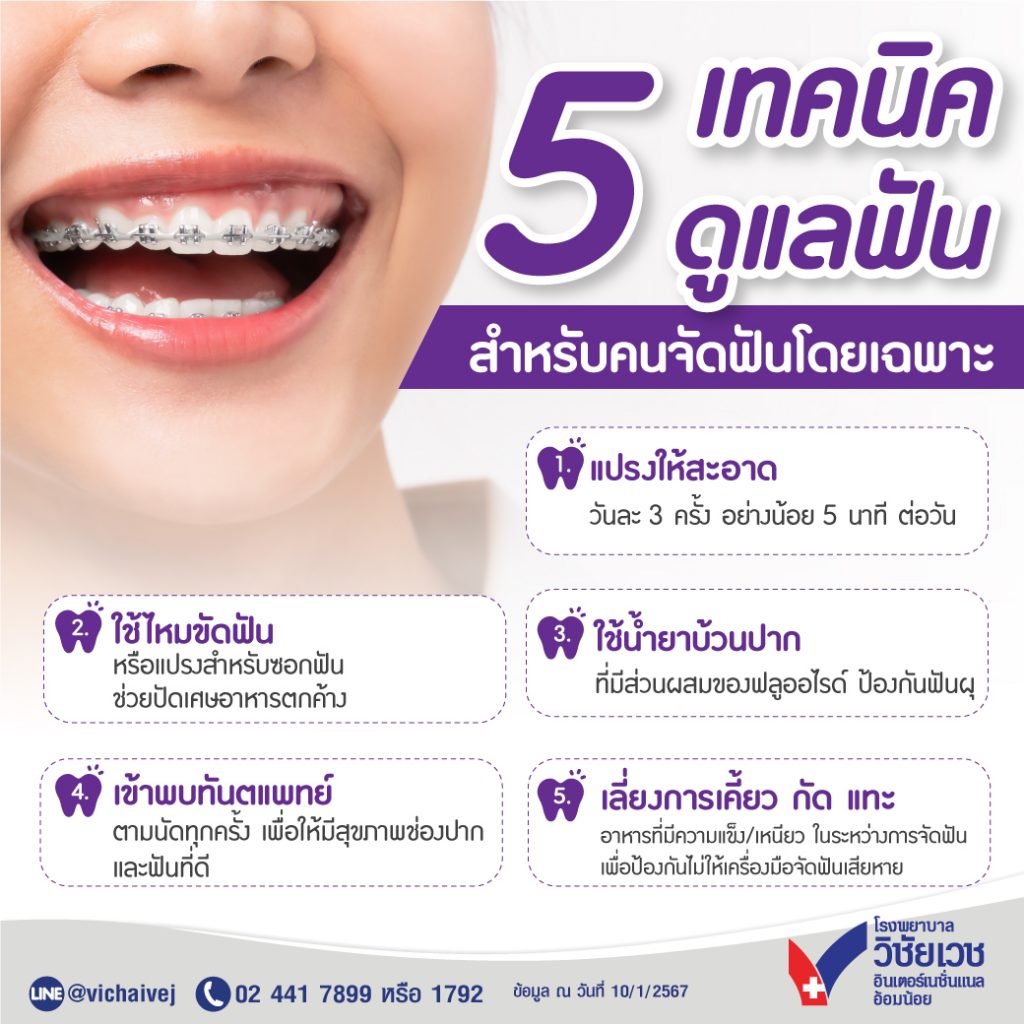 5 เทคนิคดูแลฟัน สำหรับคนจัดฟันโดยเฉพาะ