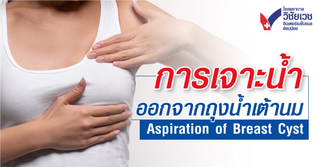 การเจาะน้ำออกจากถุงน้ำเต้านม Aspiration of Breast Cyst