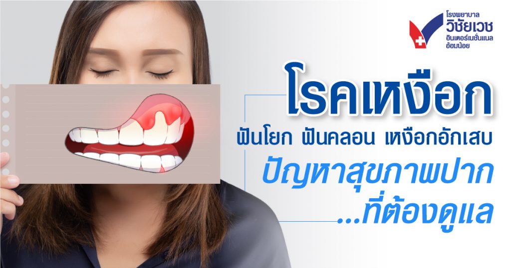โรคเหงือก ฟันโยก ฟันคลอน เหงือกอักเสบ  ปัญหาสุขภาพที่ต้องดูแล