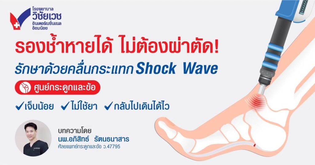 รองช้ำหายได้ ไม่ต้องผ่าตัด รักษาด้วยคลื่นกระแทก Shock Wave
