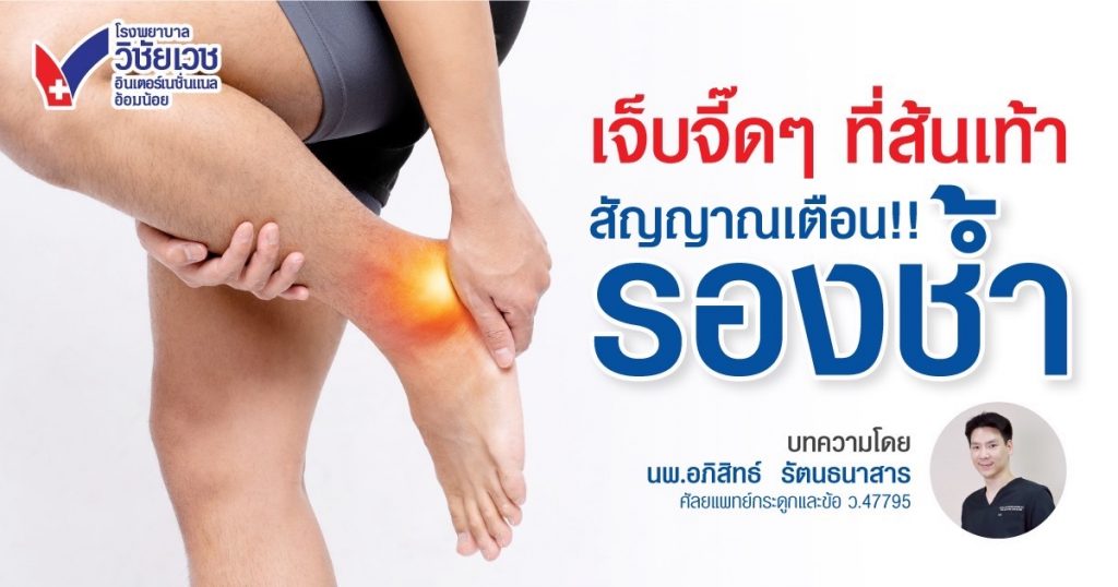 เจ็บจี๊ดที่ส้นเท้า ระวัง “โรครองช้ำ”  สาเหตุ อาการ วิธีรักษาและป้องกันแบบครบจบ
