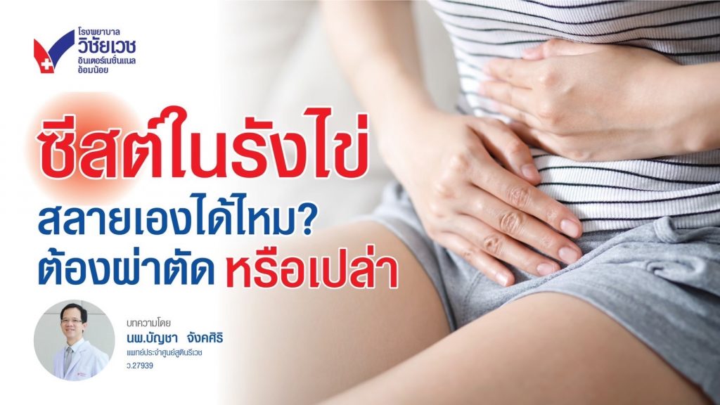 ซีสต์ในรังไข่ สลายเองได้ไหม?  ต้องผ่าตัดหรือเปล่า?