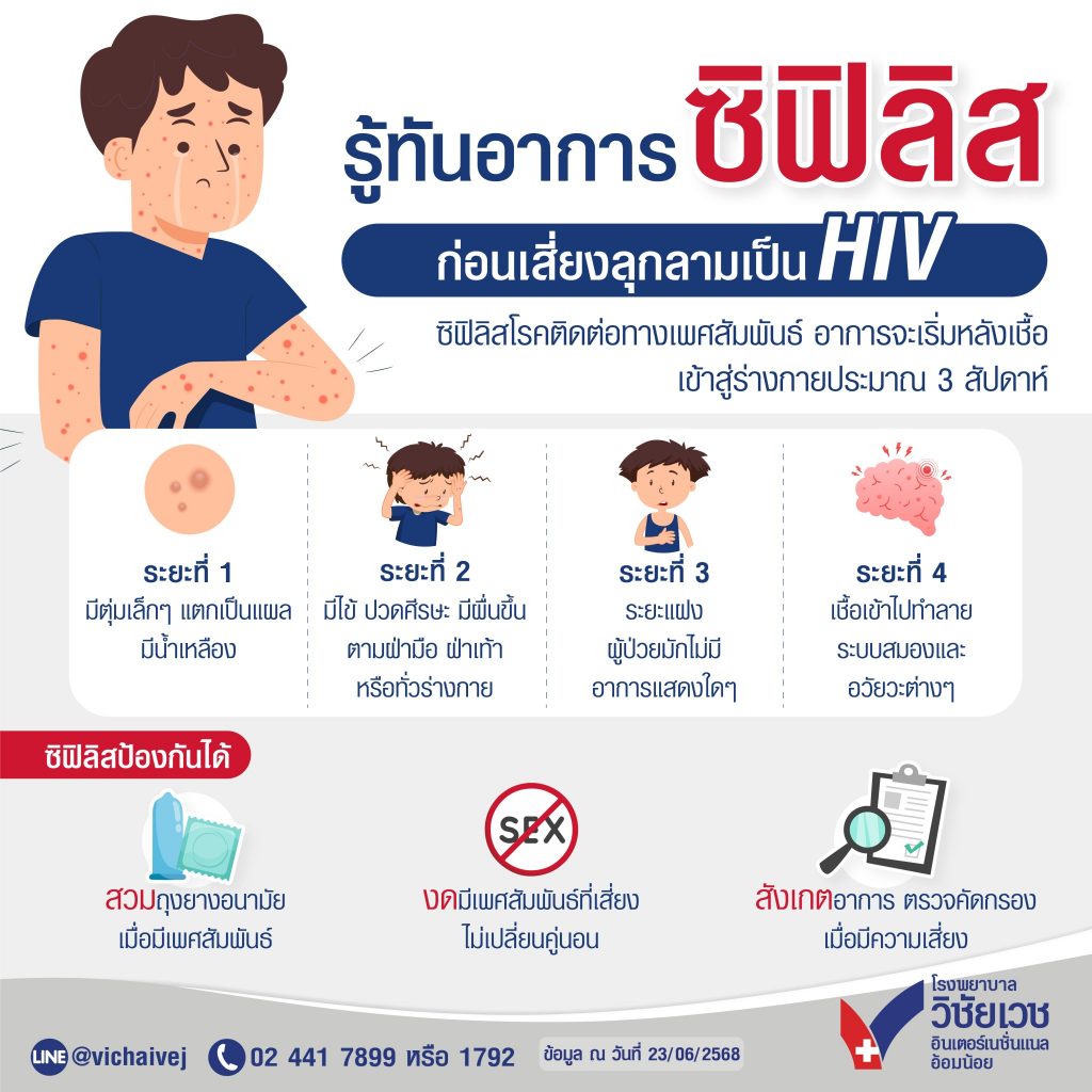 รู้ทันอาการ ซิฟิลิส ก่อนเสี่ยงลุกลามเป็น HIV