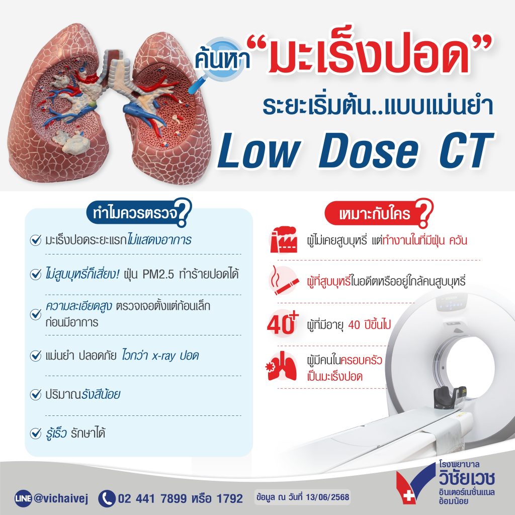 ค้นหามะเร็งปอด ระยะเริ่มต้น…แบบแม่นยำ