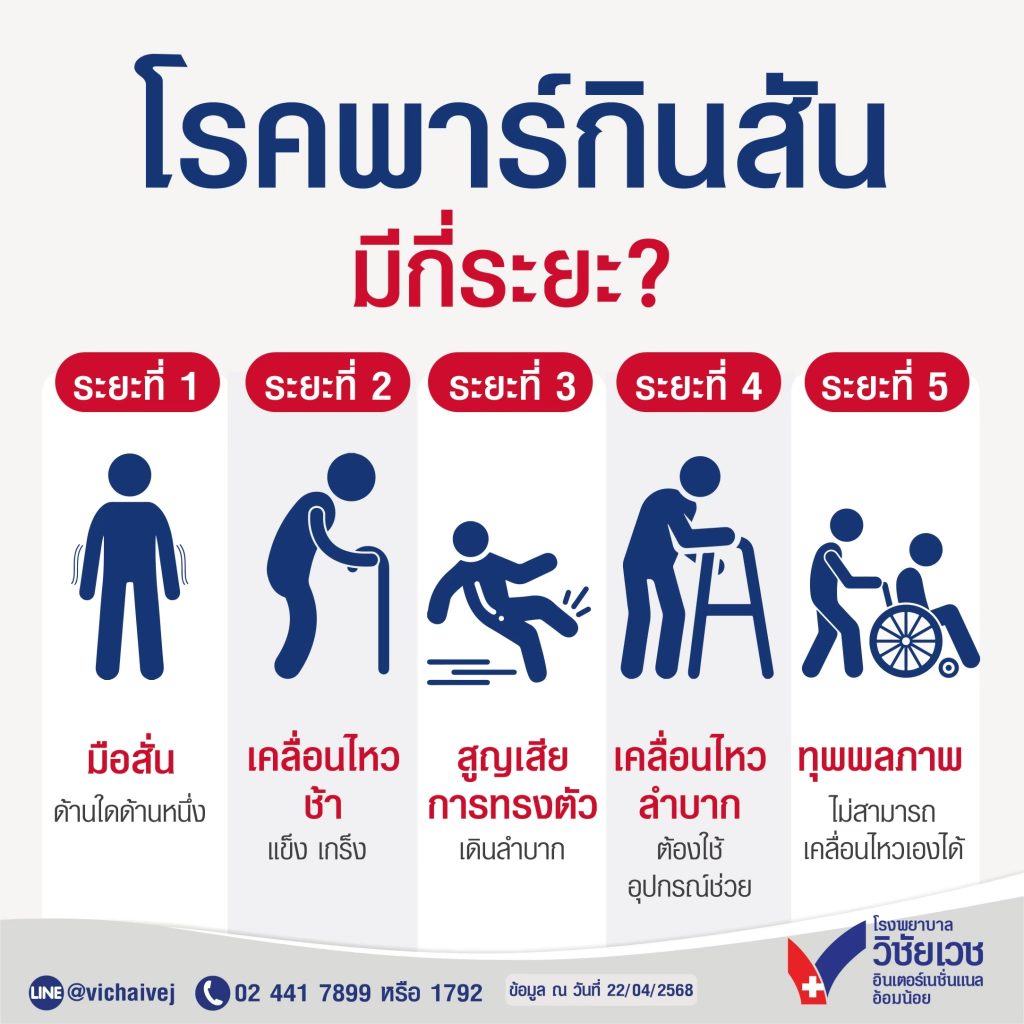 โรคพาร์กินสันมีกี่ระยะ