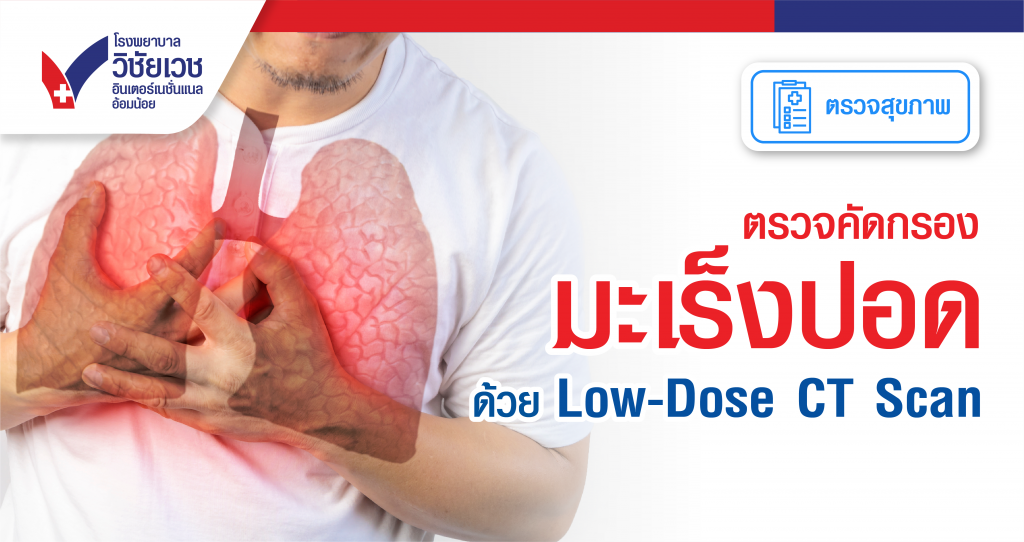ตรวจคัดกรองมะเร็งปอด ด้วย Low-dose CT Scan
