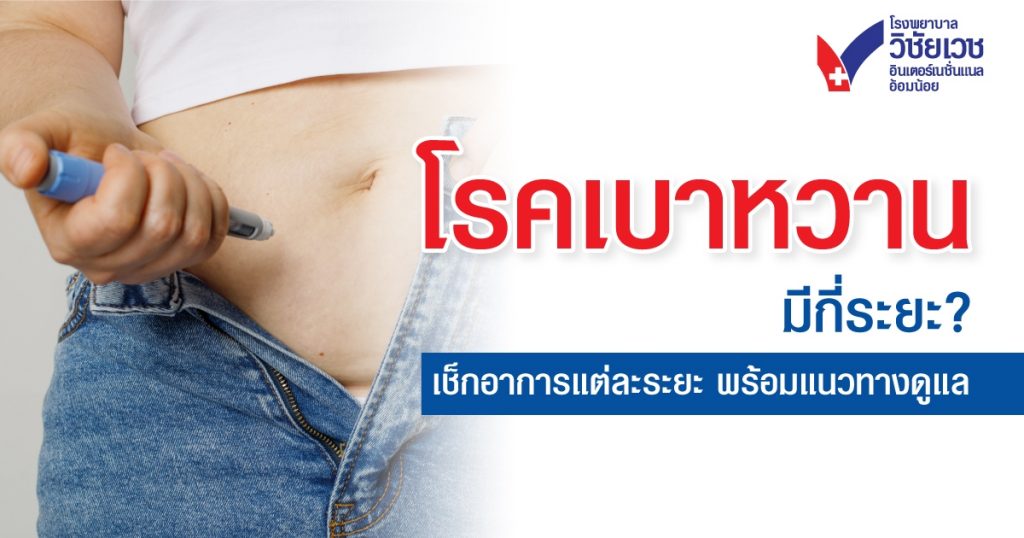 โรคเบาหวาน มีกี่ระยะ เช็กอาการแต่ละระยะ พร้อมแนวทางดูแล