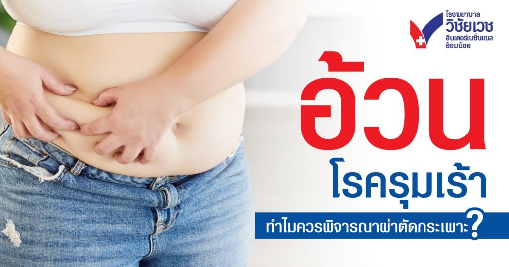 อ้วนโรครุมเร้า ทำไมควรพิจารณาผ่าตัดกระเพาะ