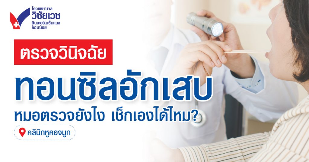 ตรวจวินิจฉัยทอนซิลอักเสบอย่างไร? รู้วิธีเช็กเอง และตรวจโดยแพทย์