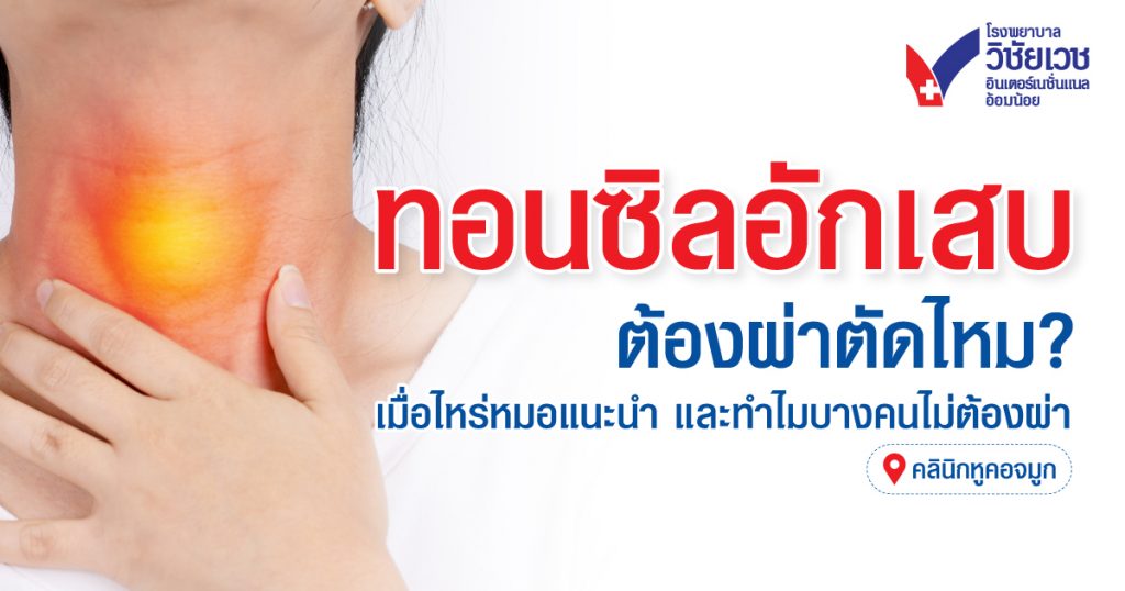ต้องผ่าตัดทอนซิลไหม? เมื่อไหร่ควรผ่า และทำไมบางคนถึงไม่ผ่า