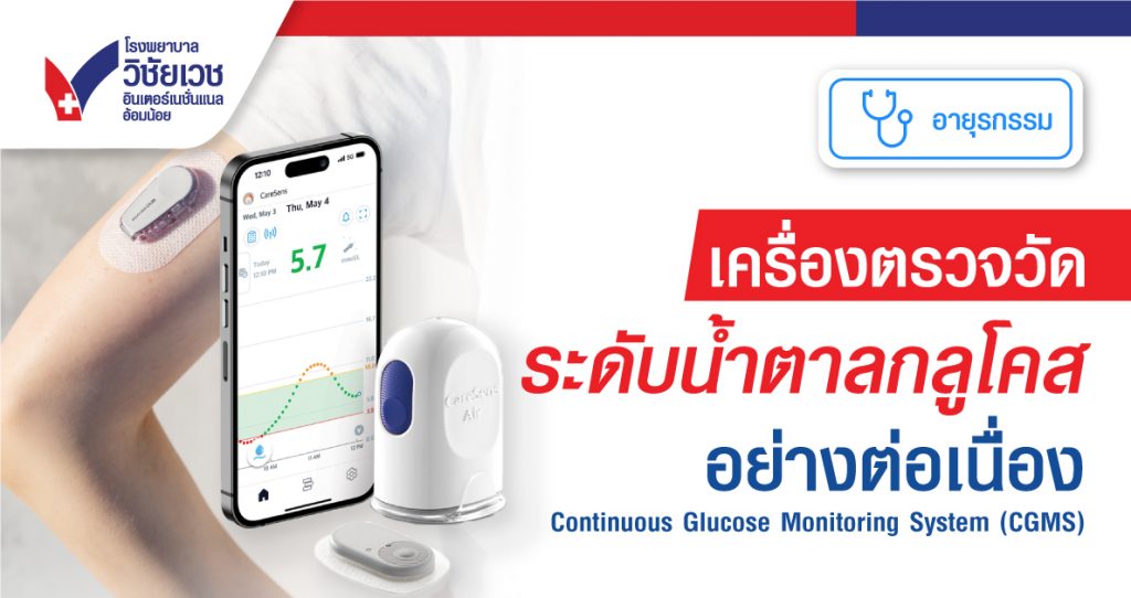 เครื่องวัดระดับน้ำตาลกลูโคสอย่างต่อเนื่อง