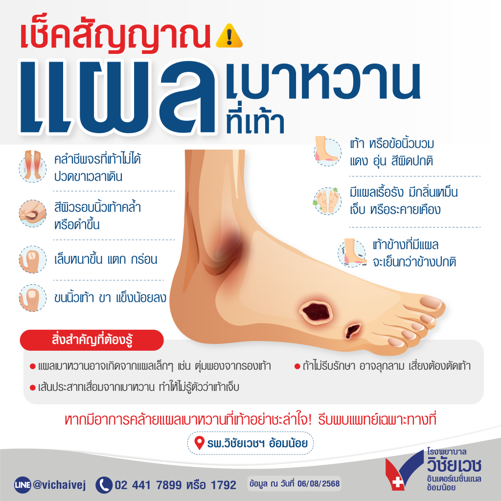 เช็คสัญญาณแผลเบาหวานที่เท้า