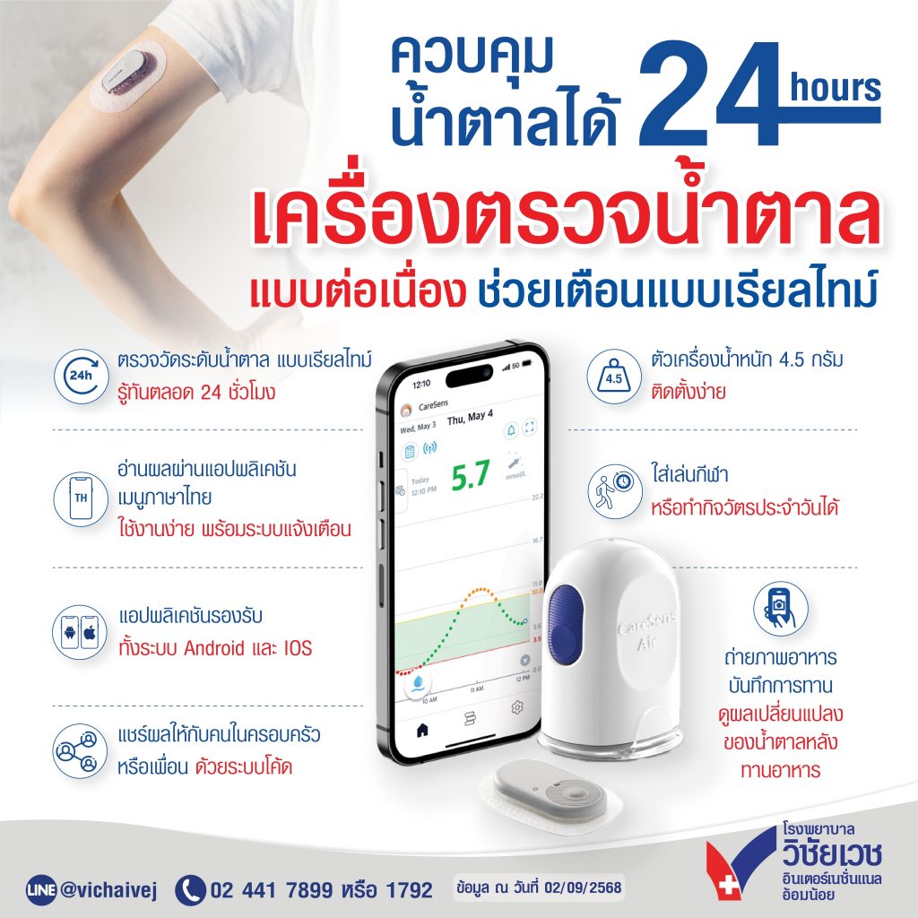 ควบคุมน้ำตาลได้ 24 ชั่วโมง เครื่องตรวจน้ำตาลแบบต่อเนื่อง ช่วยเตือนแบบเรียลไทม์