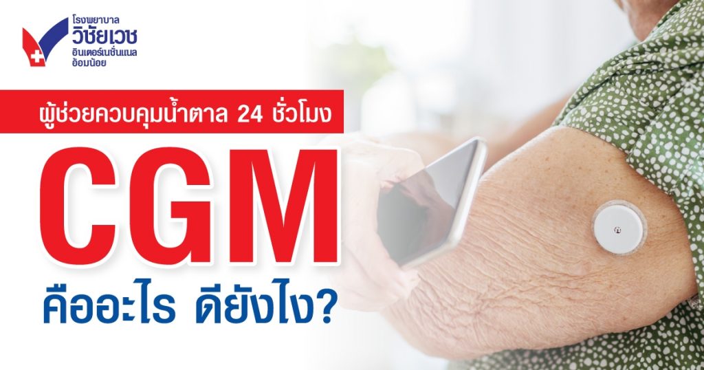 CGM เครื่องตรวจน้ำตาล 24 ชั่วโมงคืออะไร ดียังไง