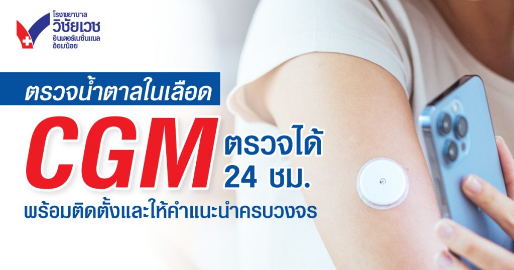 เครื่องตรวจน้ำตาลในเลือด CGM อ้อมน้อย – ใกล้คุณ พร้อมดูแลครบวงจร