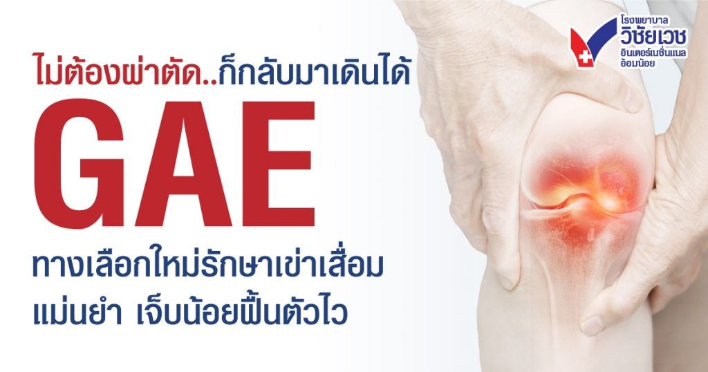 GAE รักษาปวดเข่าเรื้อรังแบบไม่ผ่าตัด เห็นผลไว ปลอดภัย พักฟื้นน้อย