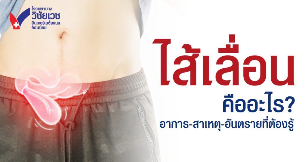 ไส้เลื่อนคืออะไร? อาการ สาเหตุ อันตรายไหม และรักษาอย่างไรให้หายเร็ว