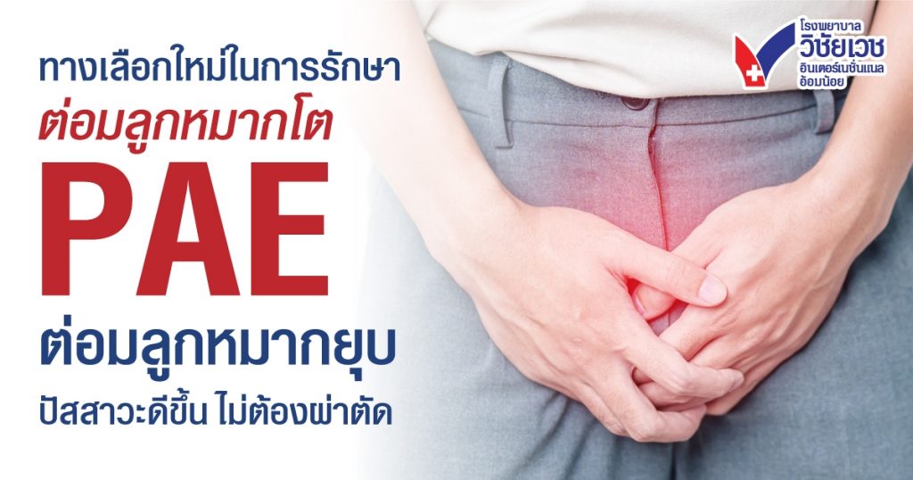 จบปัญหา 