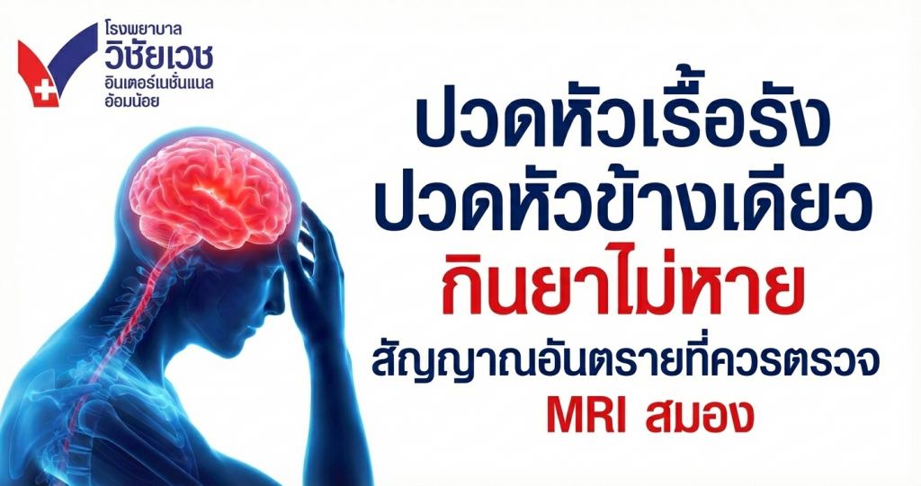ปวดหัวเรื้อรัง กินยาไม่หาย! เช็ก 5 สัญญาณอันตรายที่ควรตรวจ MRI สมองทันที