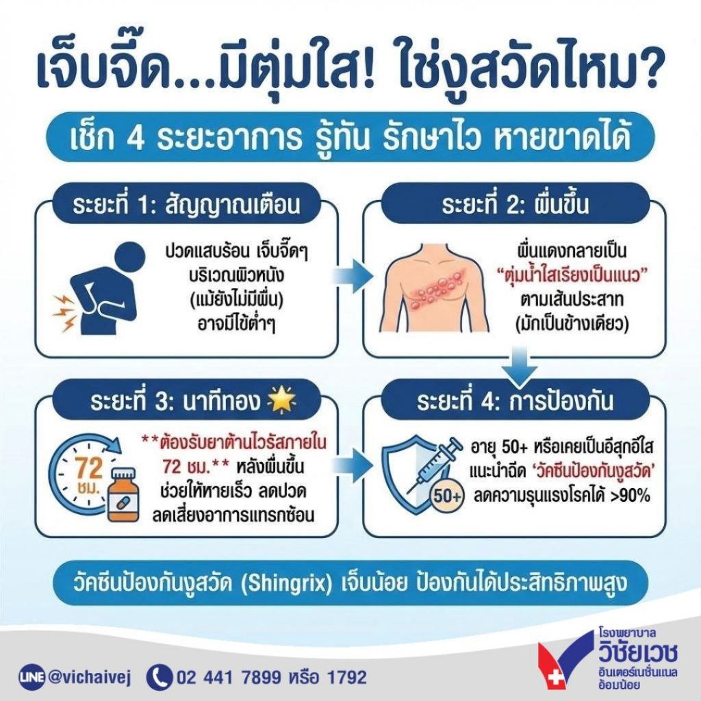 เจ็บจี๊ด…มีตุ่มใส ใช่งูสวัดไหม เช็ค 4 ระยะอาการ รู้ทัน รักษาไว หายขาดได้