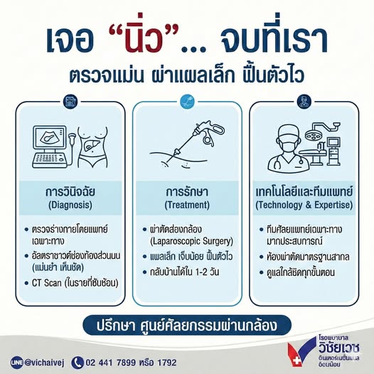 เจอ “นิ่ว”…จบที่เรา ตรวจแม่น ผ่าแผลเล็ก ฟื้นตัวไว