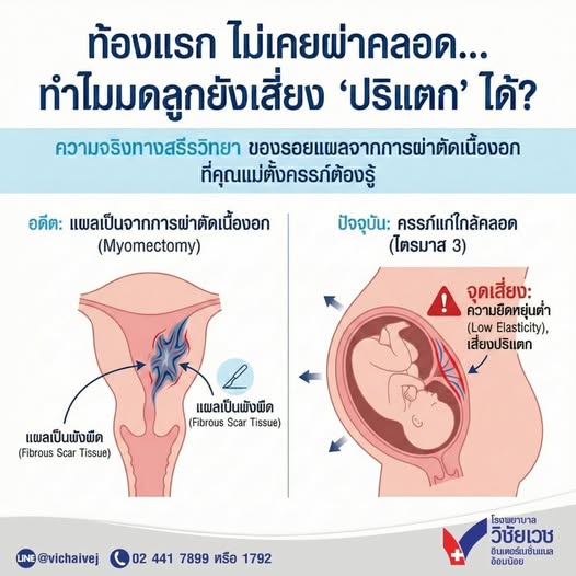 ท้องแรก ไม่เคยผ่าคลอด… ทำไมมดลูกยังเสี่ยง “ปริแตก” ได้?