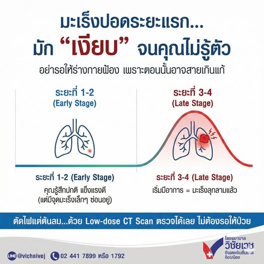 มะเร็งปอดระยะแรก มัก “เงียบ” จนคุณไม่รู้ตัว