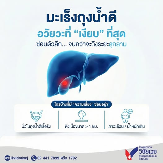 มะเร็งถุงน้ำดี อวัยวะที่ “เงียบ” ที่สุด