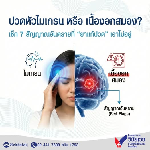 ปวดไมเกรน หรือ เนื้องอกสมอง?