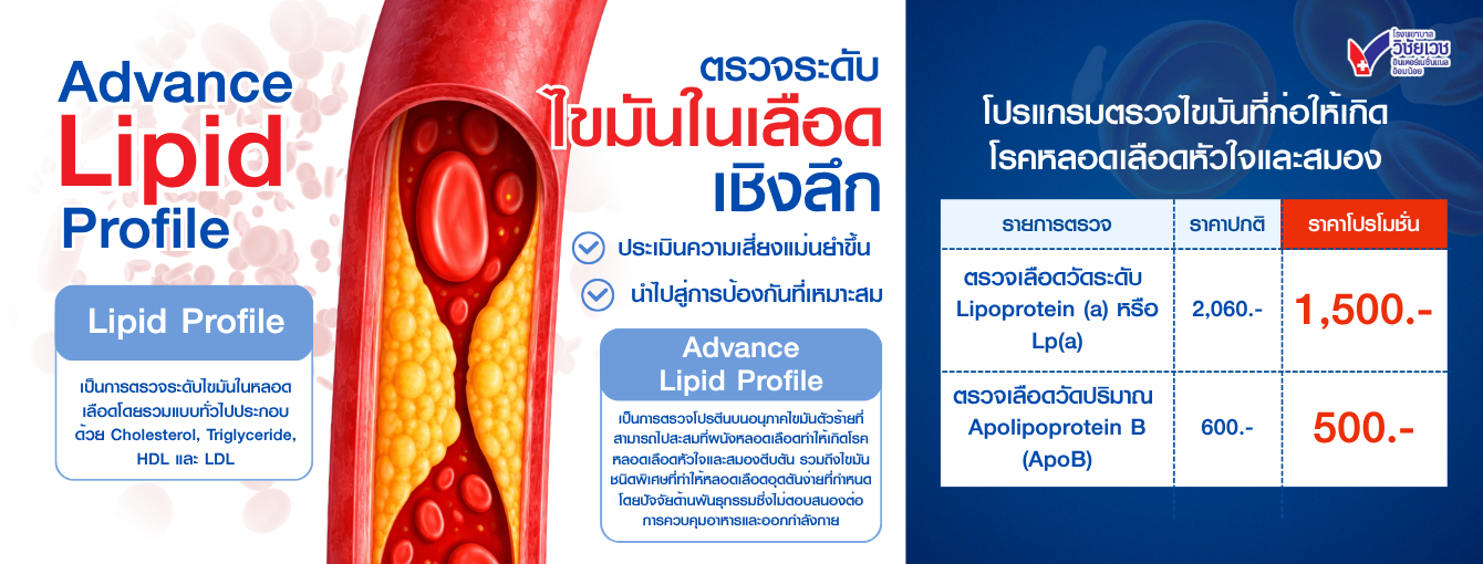 ตรวจระดับไขมันในเลือดเชิงลึก