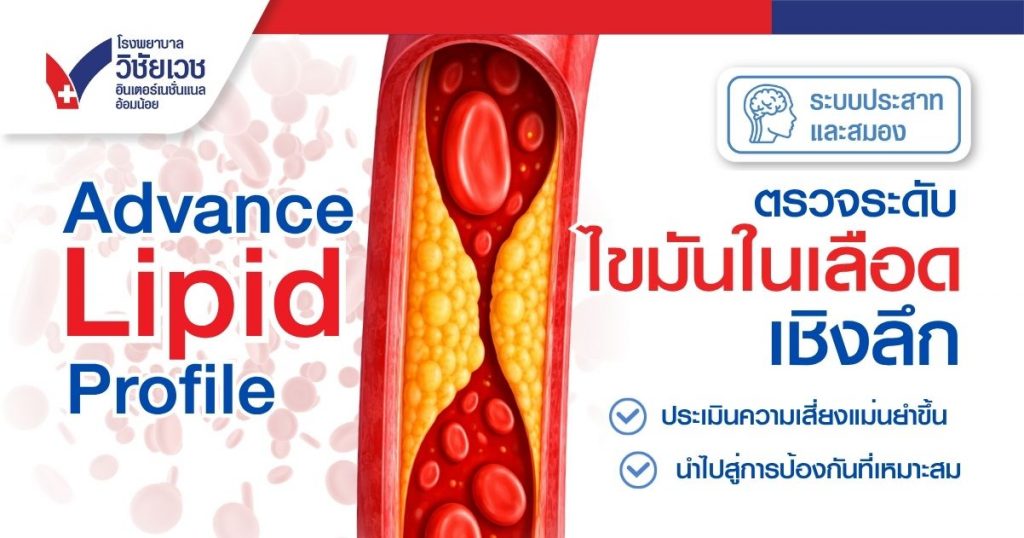 ตรวจระดับไขมันเชิงลึก Advance Lipid Profile
