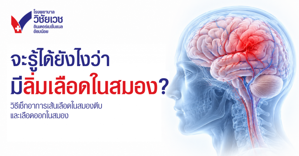 จะรู้ได้ไงว่ามีลิ่มเลือดในสมอง? วิธีเช็กอาการเส้นเลือดสมองตีบและเลือดออกในสมอง