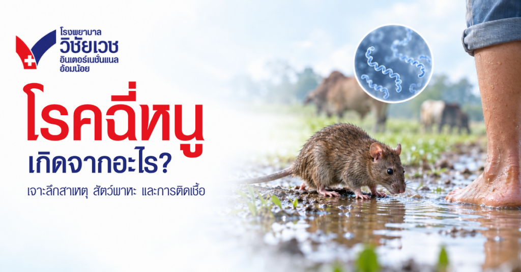 โรคฉี่หนูเกิดจากอะไร? เจาะลึกสาเหตุ สัตว์พาหะ และช่องทางการติดเชื้อ
